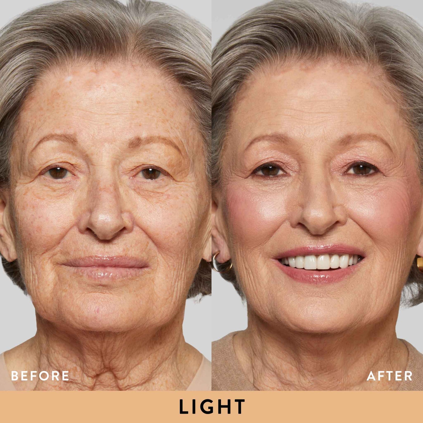 New Icons Kit (6 PC)